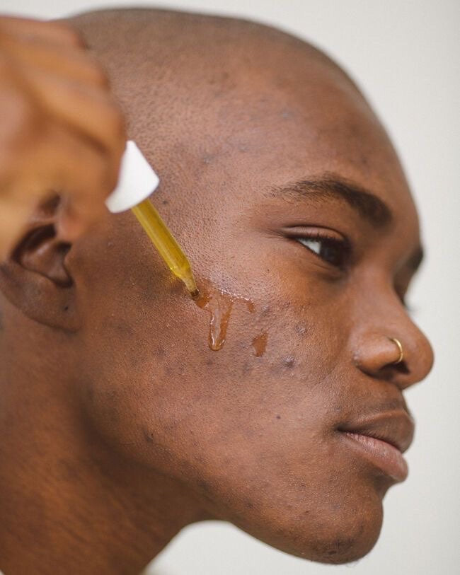 Application de l'huile de Curcuma sur le visage